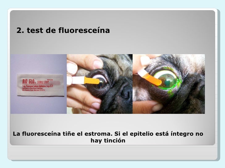 Oftalmología