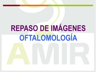 REPASO DE IMÁGENES
OFTALOMOLOGÍA

 