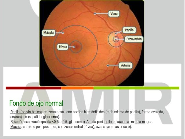 Repaso imágenes. Oftalmología. Patología de la retina.