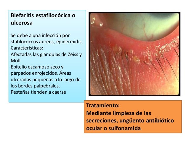 La crema la cera de la psoriasis toda la verdad