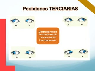 Dextroelevación
Dextrodepresión
Levoelevación
Levodepresión
Posiciones TERCIARIAS
 