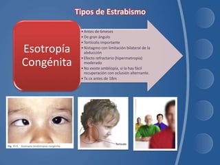 •Antes de 6meses
•De gran ángulo
•Tortícolis importante
•Nistagmo con limitación bilateral de la
abducción
•Efecto refractario (hipermetropía)
moderado
•No existe ambliopia, si la hay fácil
recuperación con oclusión alternante.
•Tx cx antes de 18m
Esotropía
Congénita
 