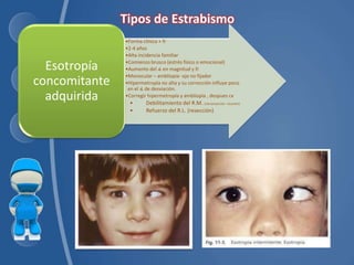 •Forma clínica + fr
•2-4 años
•Alta incidencia familiar
•Comienzo brusco (estrés físico o emocional)
•Aumento del ∡ en magnitud y fr
•Monocular – ambliopia- ojo no fijador
•Hipermetropía no alta y su corrección influye poco
en el ∡ de desviación.
•Corregir hipermetropía y ambliopía , despues cx
• Debilitamiento del R.M. (retroinserción- recesión)
• Refuerzo del R.L. (resección)
Esotropía
concomitante
adquirida
 