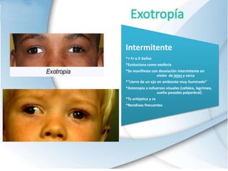 Exotropía
Intermitente
*+ Fr a 2-3años
*Evoluciona como exoforia
*Se manifiesta con desviación intermitente en
visión de lejos y cerca
*“cierre de un ojo en ambiente muy iluminado”
*Astenopia a esfuerzos visuales (cefalea, lagrimeo,
sueño pesadez palperbral)
*Tx ortóptica y cx
*Recidivas frecuentes
 