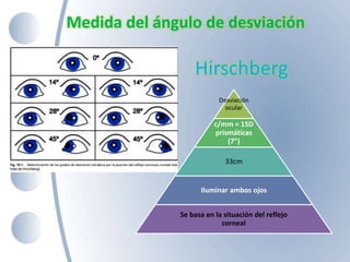 Medida del ángulo de desviación
Desviación
ocular
c/mm = 15D
prismáticas
(7”)
33cm
Iluminar ambos ojos
Se basa en la situación del reflejo
corneal
Hirschberg
 