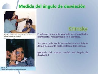 Medida del ángulo de desviación
Krimsky
El reflejo corneal esta centrado en el ojo fijador
(dominante) y descentrado en el estrábico.
Se colocan prismas de potencia creciente delante
del ojo dominante hasta centrar reflejo corneal.
(potencia del prisma- medida del ángulo de
desviación)
 