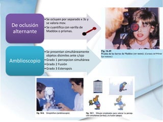•Se ocluyen por separado x 3s y
se valora mov.
•Se cuantifica con varilla de
Maddox o prismas.
De oclusión
alternante
•Se presentan simultáneamente
objetos dísimiles ante c/ojo
•Grado 1 percepcion simultánea
•Grado 2 Fusión
•Grado 3 Esteropsis
Amblioscopio
 