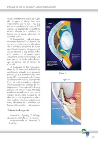 ENFOQUE CLÍNICO DEL GLAUCOMA: ¿COMO RECONOCERLO?




les con el tratamiento deben ser vigila-
dos. Los gatos no toleran bien estos
medicamentos por lo que hay que
empezar con dosis más bajas de 2-5
mg/kg. La dorzolamida (Tru-sopt®) es
el único inhibidor de la anhidrasa car-
bónica que se puede administrar vía
tópica en colirio.
    3. Bloqueantes – adrenérgicos.
                         adrenérgicos
El maleato de timolol 0.5% hasta 4% se
usa solo o combinado con inhibidores
de la anhidrasa carbónica. En huma-
nos el timolol aumenta el riego sanguí-
neo de la retina el cual protege la fun-
ción retiniana y al nervio óptico.
Actualmente existe comercializada una
combinación de timolol y dorzolamida
que se conoce con el nombre de
Cosopt®.
    4. Análogos de las prostaglan-
                            prostaglan-
dinas F2. El latanoprost (Xalatan®) es
ampliamente utilizado en el glaucoma               Figura 13.
primario ya que aumenta el flujo uveo-

                                                       Figura 14.
escleral (vía no convencional) mediante
la relajación del músculo ciliar remode-
lando su matriz extracelular y disminu-
yendo su resistencia a la salida del HA.
Requiere una única aplicación diaria y
produce una intensa miosis. Ha dado
excelentes resultados en el perro y en el
caballo, pero no tanto en gatos. Se ha
demostrado que se potencia su efecto
si se combina con otros medicamentos
como inhibidores de la anhidrasa car-
bónica o bloqueantes -adrenérgicos.

Tratamiento de urgencia

   Manitol IV, 1-2gr/Kg. (7.5ml/Kg.
de solución al 20%) en 15 minutos.
   Acetazolamida IV (Diamox) 5-
10mg/Kg.




                                                                    77
 