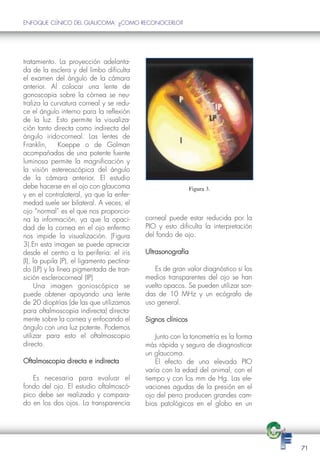 ENFOQUE CLÍNICO DEL GLAUCOMA: ¿COMO RECONOCERLO?




tratamiento. La proyección adelanta-
da de la esclera y del limbo dificulta
el examen del ángulo de la cámara
anterior. Al colocar una lente de
gonoscopia sobre la córnea se neu-
traliza la curvatura corneal y se redu-
ce el ángulo interno para la reflexión
de la luz. Esto permite la visualiza-
ción tanto directa como indirecta del
ángulo irido-corneal. Las lentes de
Franklin,     Koeppe o de Golman
acompañadas de una potente fuente
luminosa permite la magnificación y
la visión estereoscópica del ángulo
de la cámara anterior. El estudio
debe hacerse en el ojo con glaucoma                           Figura 3.
y en el contralateral, ya que la enfer-
medad suele ser bilateral. A veces, el
ojo “normal” es el que nos proporcio-
na la información, ya que la opaci-         corneal puede estar reducida por la
dad de la cornea en el ojo enfermo          PIO y esto dificulta la interpretación
nos impide la visualización. (Figura        del fondo de ojo.
3).En esta imagen se puede apreciar
desde el centro a la periferia: el iris     Ultrasonografía
(I), la pupila (P), el ligamento pectina-
do (LP) y la línea pigmentada de tran-         Es de gran valor diagnóstico si los
sición esclerocorneal (IP)                  medios transparentes del ojo se han
     Una imagen gonioscópica se             vuelto opacos. Se pueden utilizar son-
puede obtener apoyando una lente            das de 10 MHz y un ecógrafo de
de 20 dioptrías (de las que utilizamos      uso general.
para oftalmoscopia indirecta) directa-
mente sobre la cornea y enfocando el        Signos clínicos
ángulo con una luz potente. Podemos
utilizar para esto el oftalmoscopio             Junto con la tonometría es la forma
directo.                                    más rápida y segura de diagnosticar
                                            un glaucoma.
Oftalmoscopia directa e indirecta               El efecto de una elevada PIO
                                            varía con la edad del animal, con el
   Es necesaria para evaluar el             tiempo y con los mm de Hg. Las ele-
fondo del ojo. El estudio oftalmoscó-       vaciones agudas de la presión en el
pico debe ser realizado y compara-          ojo del perro producen grandes cam-
do en los dos ojos. La transparencia        bios patológicos en el globo en un




                                                                                      71
 
