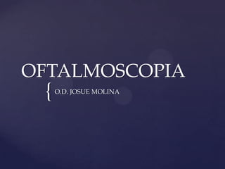 OFTALMOSCOPIA
 {   O.D. JOSUE MOLINA
 