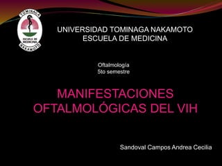 MANIFESTACIONES
OFTALMOLÓGICAS DEL VIH
UNIVERSIDAD TOMINAGA NAKAMOTO
ESCUELA DE MEDICINA
Oftalmología
5to semestre
Sandoval Campos Andrea Cecilia
 