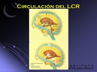 Oft enfermedades del nervio optico2. retinoblastoma. | PPT