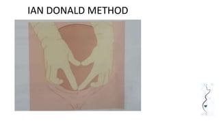 IAN DONALD METHOD
 