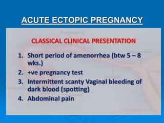 ACUTE ECTOPIC PREGNANCY
 