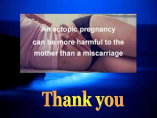 Ectopic Pregnancy.pptx