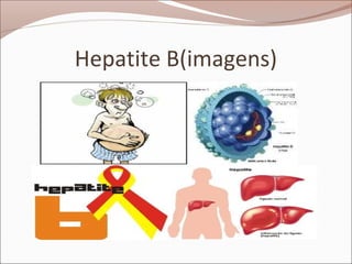 Hepatite B(imagens)
 