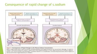 Consequence of rapid change of s.sodium
 