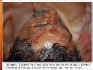 18.abr.1996 - Sem-terra morto pela Polícia Militar com um tiro na cabeça durante o
massacre de Eldorado dos Carajás, no Instituto Médico Legal (IML) de Marabá (PA).
 