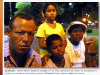 08.abr.2003 - Josimar Pereira de Freitas, atingido com um tiro na perna durante o massacre de Eldorado dos
Carajás, acompanhado de Rubenita Justiniano da Silva (à direita), baleada na boca, em Belém.
 