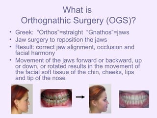 Ogs 2014 color | PPT