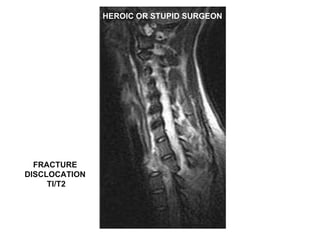 HEROIC OR STUPID SURGEON FRACTURE  DISCLOCATION  TI/T2 