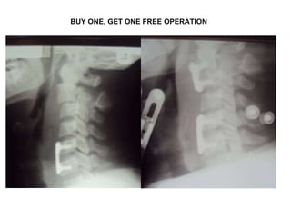 BUY ONE, GET ONE FREE OPERATION 