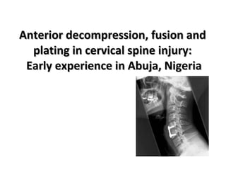 Anterior decompression, fusion and  plating in cervical spine injury:  Early experience in Abuja, Nigeria   