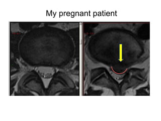 My pregnant patient 
