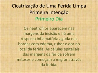 Cicatrização de Uma Ferida Limpa
Primeira Intenção
Primeiro Dia
Os neutrófilos aparecem nas
margens da incisão e há uma
resposta inflamatória aguda nas
bordas com edema, rubor e dor no
local da ferida. As células epiteliais
das margens da ferida sofrem
mitoses e começam a migrar através
da ferida.
 