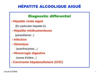 HÉPATITE ALCOOLIQUE AIGUË
Diagnostic différentiel
- Hépatite virale aiguë 
(En particulier hépatite E) 
- Hépatite médicam...