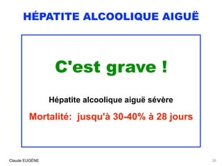 HÉPATITE ALCOOLIQUE AIGUË
C'est grave !
Hépatite alcoolique aiguë sévère
Mortalité: jusqu'à 30-40% à 28 jours
Claude EUGÈN...