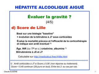 HÉPATITE ALCOOLIQUE AIGUË
Évaluer la gravité ?
(4/5)
d) Score de Lille 
Basé sur une biologie "baseline" 
+ évolution de l...