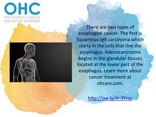 There	are	two	types	of	
esophageal	cancer.	The	ﬁrst	is	
Squamous	cell	carcinoma	which	
starts	in	the	cells	that	line	the	
esophagus.	Adenocarcinoma	
begins	in	the	glandular	<ssues	
located	at	the	lower	part	of	the	
esophagus.	Learn	more	about	
cancer	treatment	at	
ohcare.com.		
	
h>p://ow.ly/4n3Ymc	
 