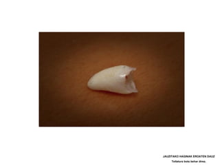 JAUZITAKO HAGINAK EROATEN DAUZ
     Teilatura bota behar direz.
 