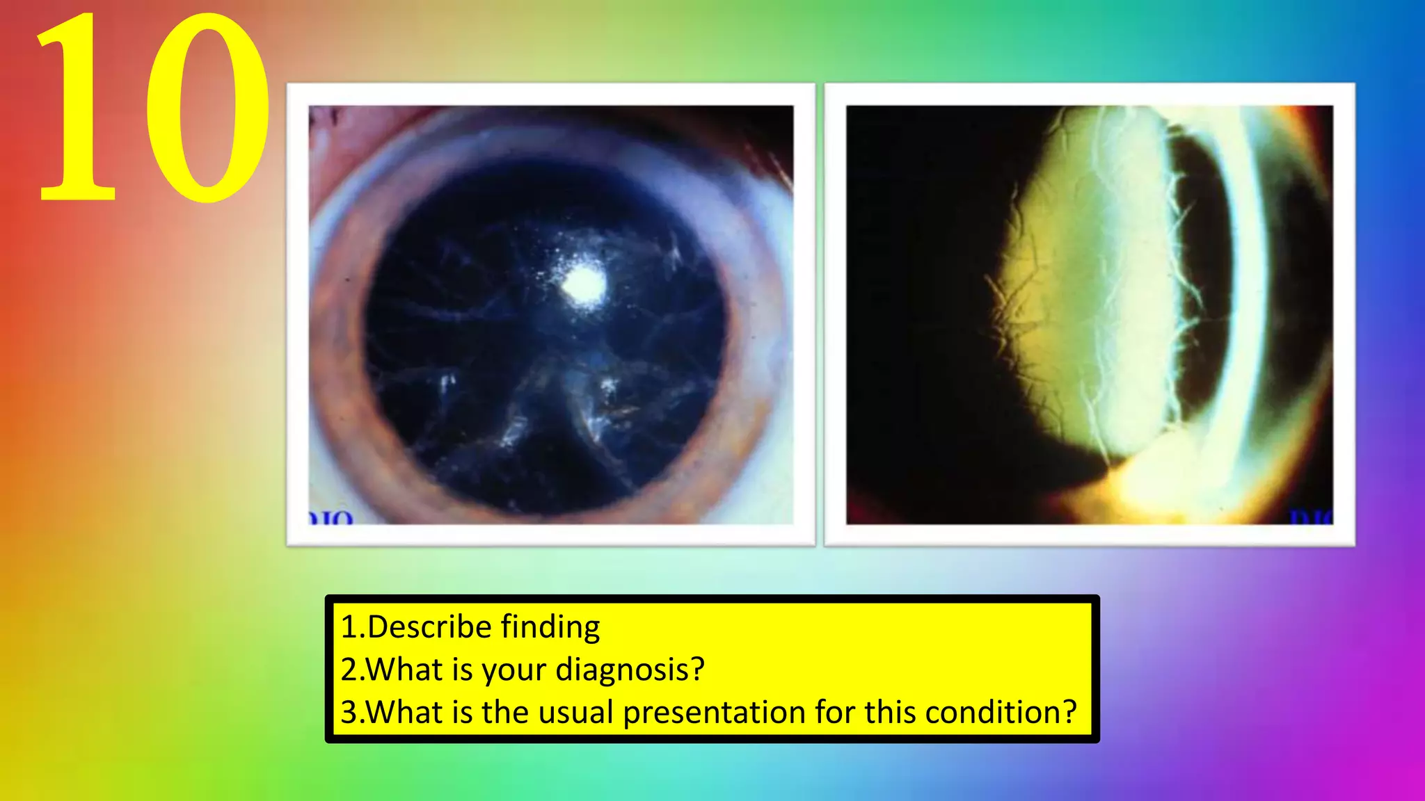 10
1.Describe finding
2.What is your diagnosis?
3.What is the usual presentation for this condition?
 