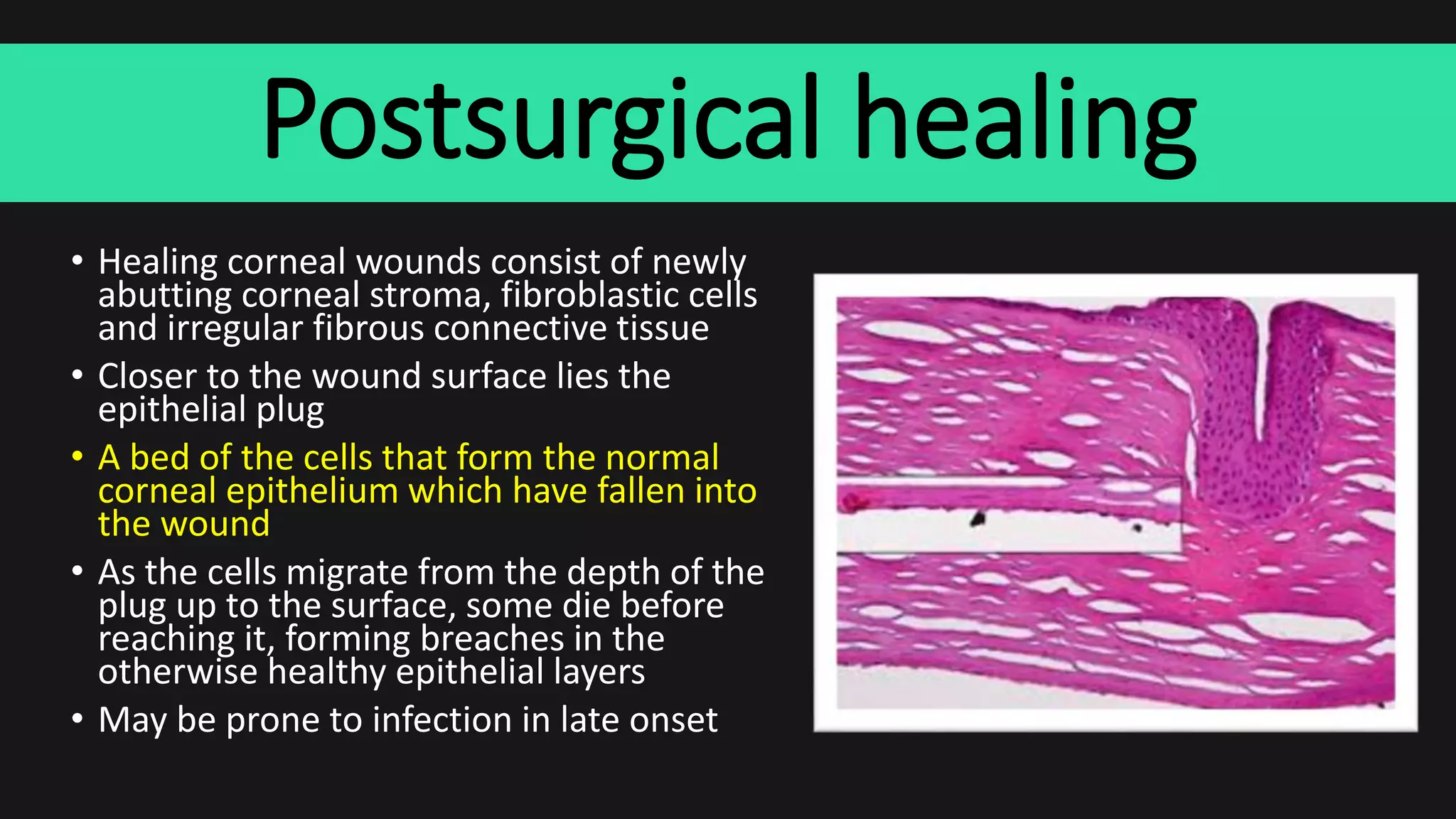 Postsurgical healing
• Healing corneal wounds consist of newly
abutting corneal stroma, fibroblastic cells
and irregular fibrous connective tissue
• Closer to the wound surface lies the
epithelial plug
• A bed of the cells that form the normal
corneal epithelium which have fallen into
the wound
• As the cells migrate from the depth of the
plug up to the surface, some die before
reaching it, forming breaches in the
otherwise healthy epithelial layers
• May be prone to infection in late onset
 