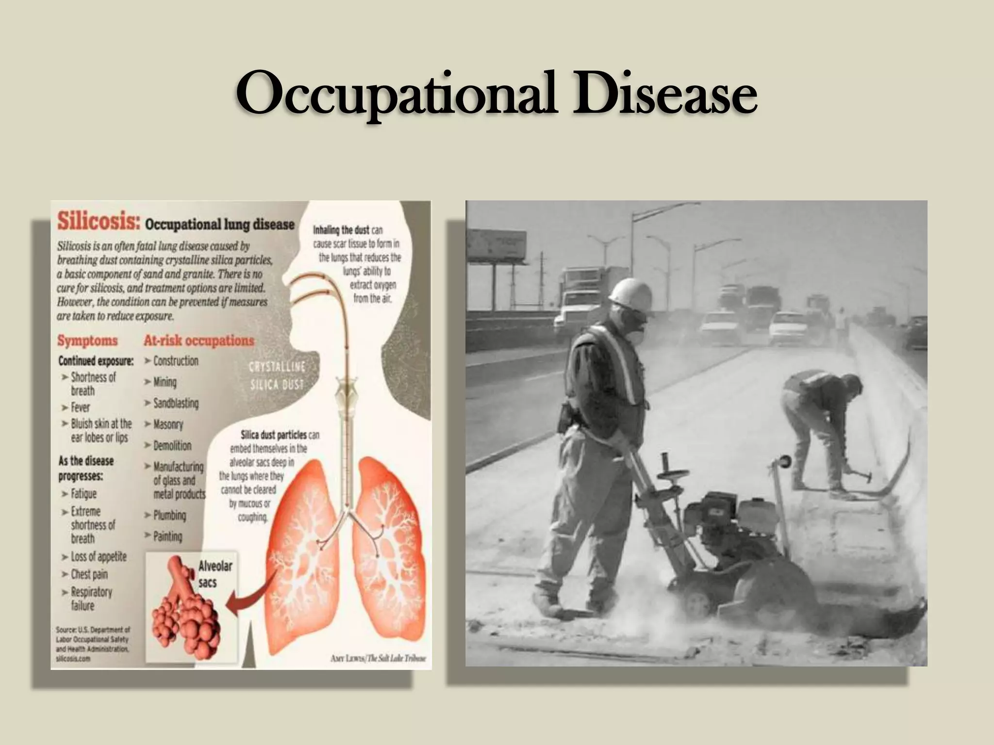 Occupational Disease

 
