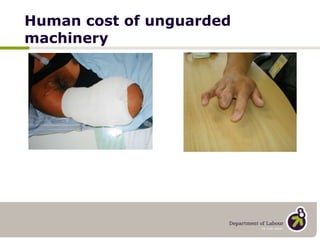 Human cost of unguarded machinery 