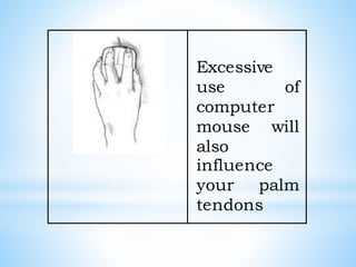 Excessive
use of
computer
mouse will
also
influence
your palm
tendons
 