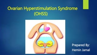 Ovarian Hyperstimulation Syndrome
(OHSS)
Prepared By:
Hemin Jamal
 