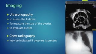 Imaging
 Ultrasonography
 to assess the follicles
 To measure the size of the ovaries
 to evaluate ascites
 Chest radiography
 may be indicated if dyspnea is present.
 