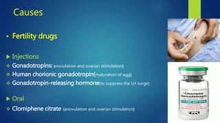 Causes
 Fertility drugs
 Injections
 Gonadotropins( anovulation and ovarian stimulation)
 Human chorionic gonadotropin(maturation of egg)
 Gonadotropin-releasing hormone(to suppress the LH surge)
 Oral
 Clomiphene citrate (anovulation and ovarian stimulation)
 