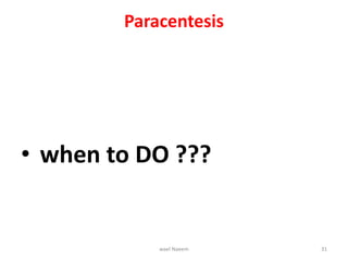 Paracentesis
• when to DO ???
wael Naeem 31
 