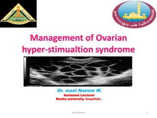 Management of Ovarian
hyper-stimualtion syndrome
Dr. wael Naeem M.
Assistant Lecturer
Benha university hospitals .
1wael Naeem
 