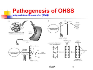 Pathogenesis of OHSS
adopted from Soares et al (2008)
8WARDA
 