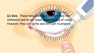 (c) Gels. These have prolonged contact time like
ointments and do not cause much blurring of vision.
However, they are costly and difficult to prepare.
 