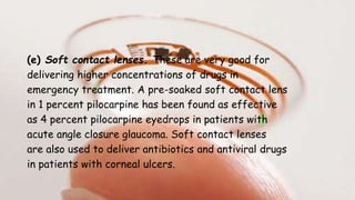 (e) Soft contact lenses. These are very good for
delivering higher concentrations of drugs in
emergency treatment. A pre-soaked soft contact lens
in 1 percent pilocarpine has been found as effective
as 4 percent pilocarpine eyedrops in patients with
acute angle closure glaucoma. Soft contact lenses
are also used to deliver antibiotics and antiviral drugs
in patients with corneal ulcers.
 