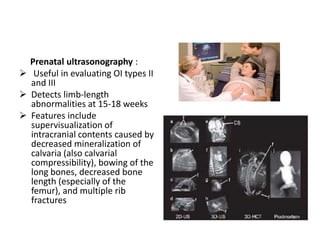 Prenatal ultrasonography :
 Useful in evaluating OI types II
  and III
 Detects limb-length
  abnormalities at 15-18 weeks
 Features include
  supervisualization of
  intracranial contents caused by
  decreased mineralization of
  calvaria (also calvarial
  compressibility), bowing of the
  long bones, decreased bone
  length (especially of the
  femur), and multiple rib
  fractures
 