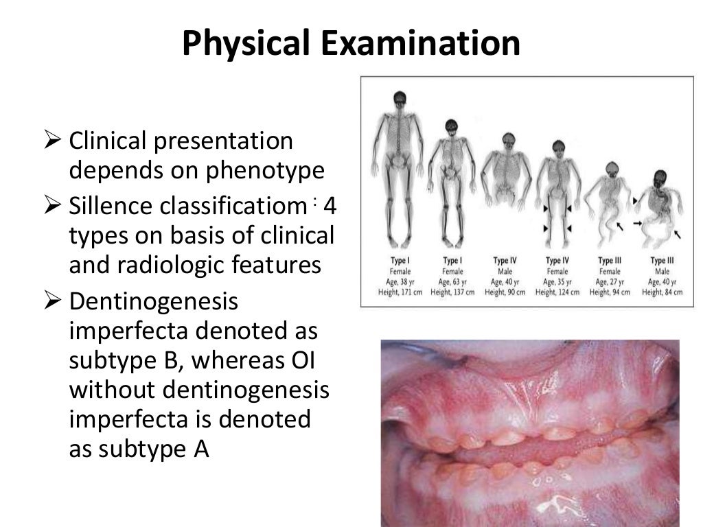 Osteogenesis Imperfecta