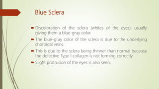 Blue Sclera
 Discoloration of the sclera (whites of the eyes), usually
giving them a blue-gray color.
 The blue-gray color of the sclera is due to the underlying
choroidal veins.
 This is due to the sclera being thinner than normal because
the defective Type I collagen is not forming correctly.
 Slight protrusion of the eyes is also seen.
 